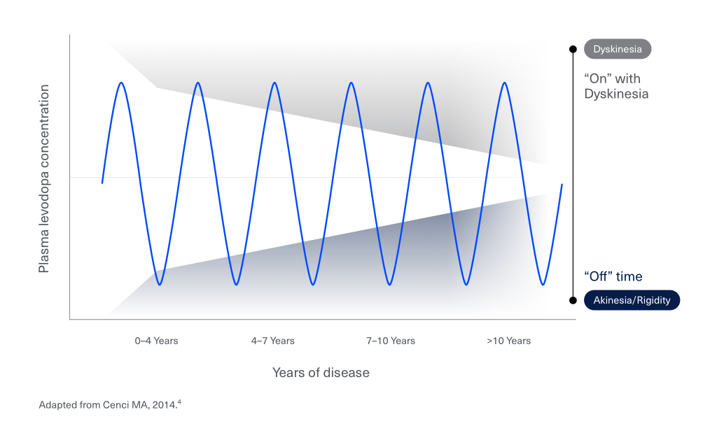 produodopa-global-en-chart-disease-progression-v2-1100