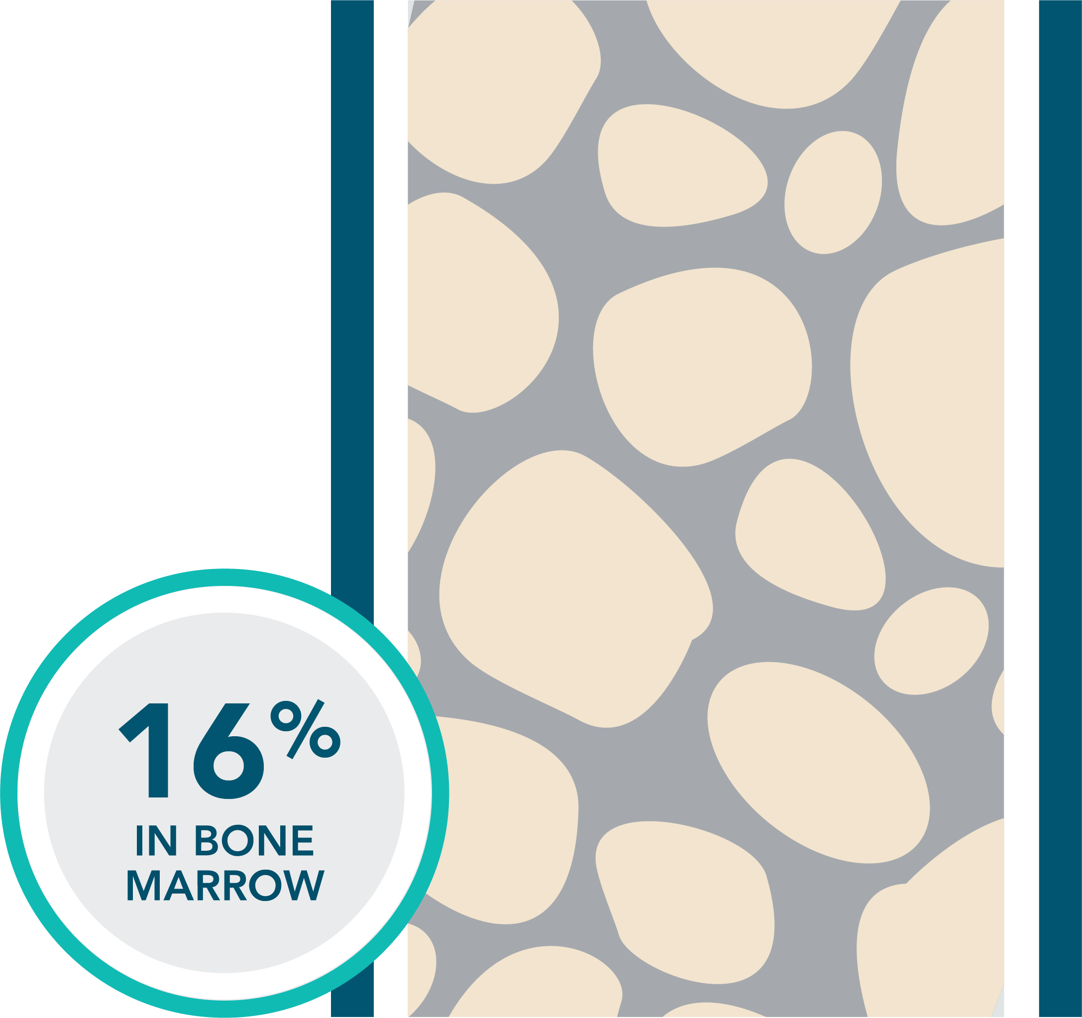 Previously-treated VEN+R patients: 16% undetectable MRD in bone marrow