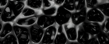 Myelofibrosis-Progression-hero-abbviepro