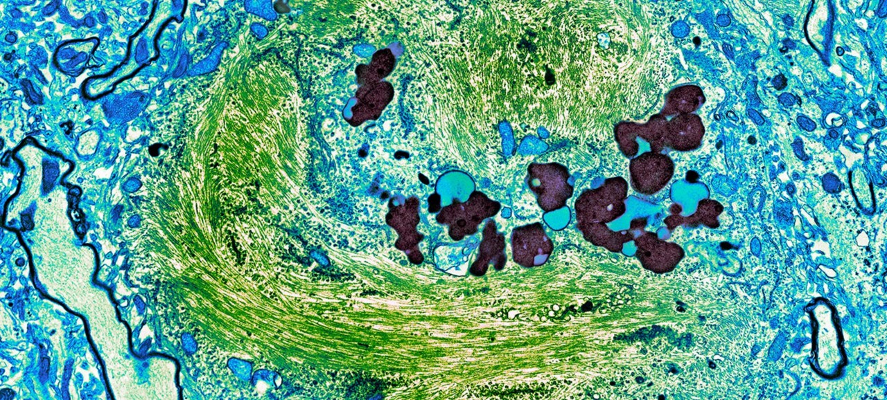 titelbild-neurologie